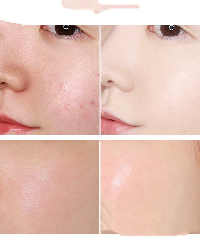 Salicylic Acid Serum - Salicylic Acid Pore Reducing Serum - Salicylic Acid 2 Serum