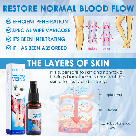 30Ml Varicose Vein Spray Multi-Purpose Knee And Leg Care Spray Promote Blood Circulation